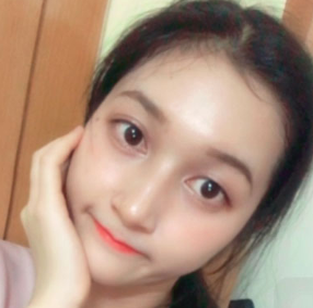 上海時(shí)光整形醫(yī)院做面部玻尿酸注射效果怎么樣？