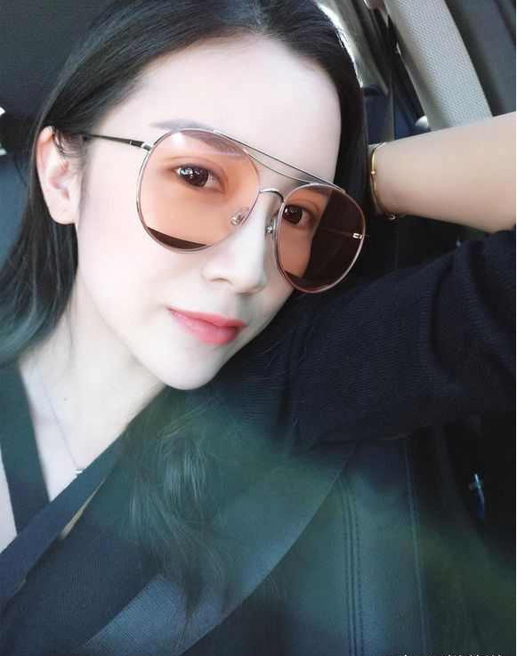 上海時光整形醫(yī)院張晶醫(yī)生做開眼角怎么樣？附真實(shí)效果圖