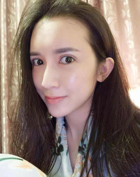 上海時光整形醫(yī)院張晶醫(yī)生做開眼角怎么樣？附真實(shí)效果圖