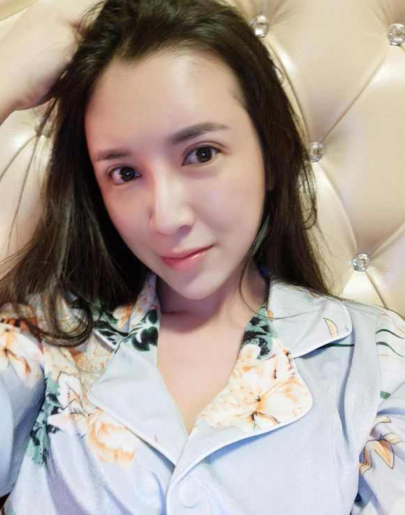 上海時光整形醫(yī)院張晶醫(yī)生做開眼角怎么樣？附真實(shí)效果圖