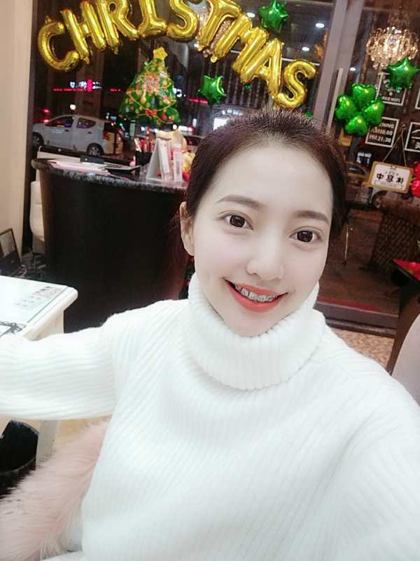 巴中華醫(yī)口腔醫(yī)院做牙齒矯正效果好嗎？附母汶靈醫(yī)生牙齒矯正案例效果圖
