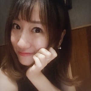 蚌埠韓美美萊整形做玻尿酸面部除皺效果怎么樣？附陳澤醫(yī)生案例效果圖