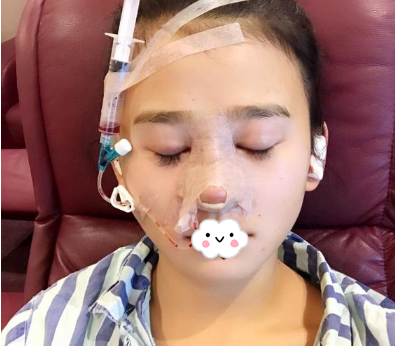 蚌埠韓美美萊整形醫(yī)生歷芳做耳軟骨隆鼻怎么樣？附耳軟骨隆鼻案例對(duì)比圖