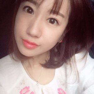 蚌埠韓美美萊整形做玻尿酸面部除皺效果怎么樣？附陳澤醫(yī)生案例效果圖