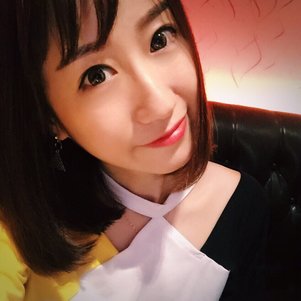 蚌埠韓美美萊整形做玻尿酸面部除皺效果怎么樣？附陳澤醫(yī)生案例效果圖