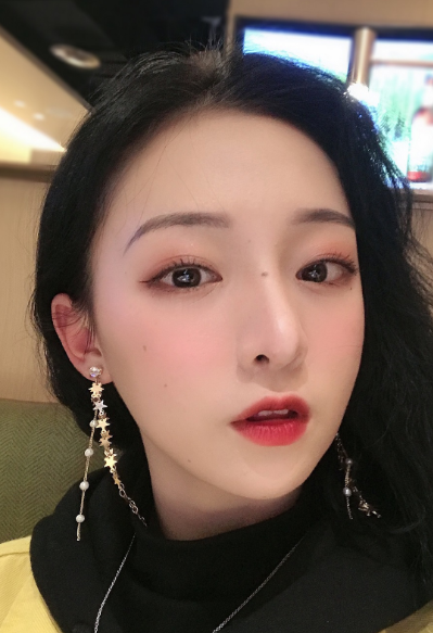 周娜醫(yī)生縮鼻頭案例效果圖