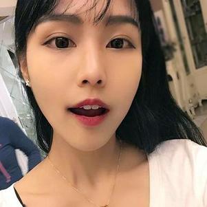 鞍山時代口腔門診部洗牙效果怎么樣？附申元休醫(yī)生洗牙案例效果圖