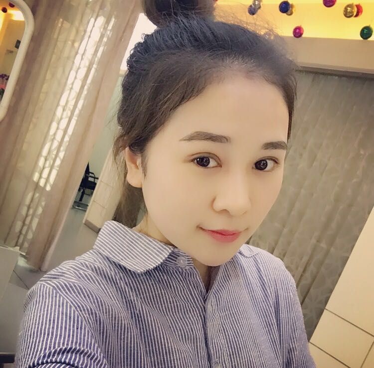蚌埠韓美美萊整形醫(yī)生鄭捷做開眼角怎么樣？附案例效果圖