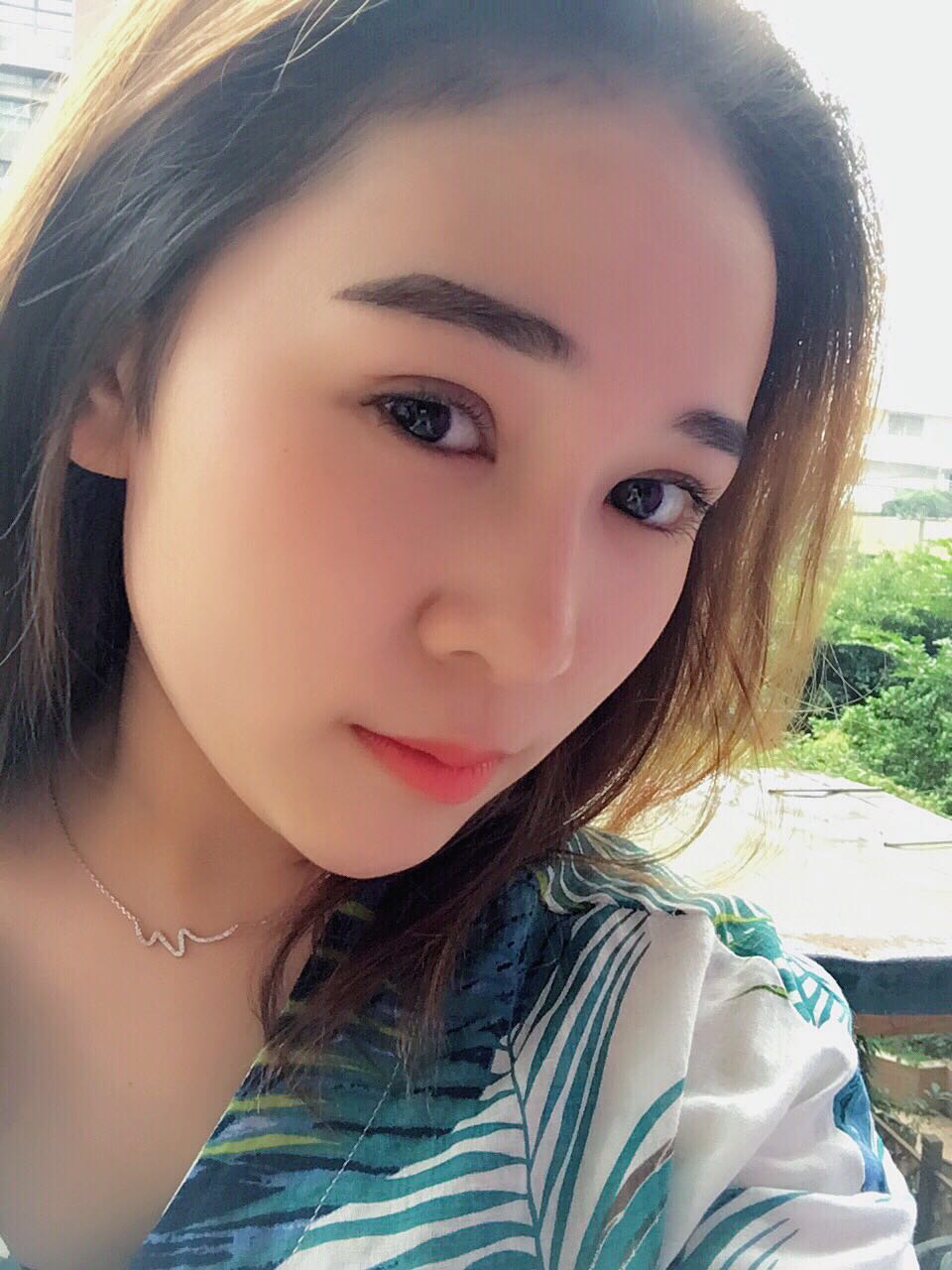 蚌埠韓美美萊整形醫(yī)生鄭捷做開眼角怎么樣？附案例效果圖