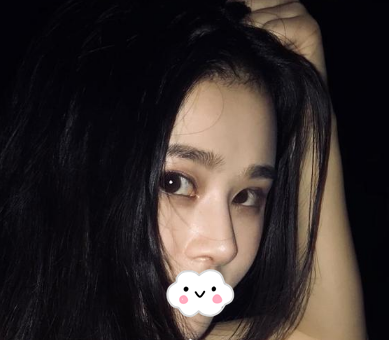 蚌埠韓美美萊整形醫(yī)生歷芳做耳軟骨隆鼻怎么樣？附耳軟骨隆鼻案例對比圖