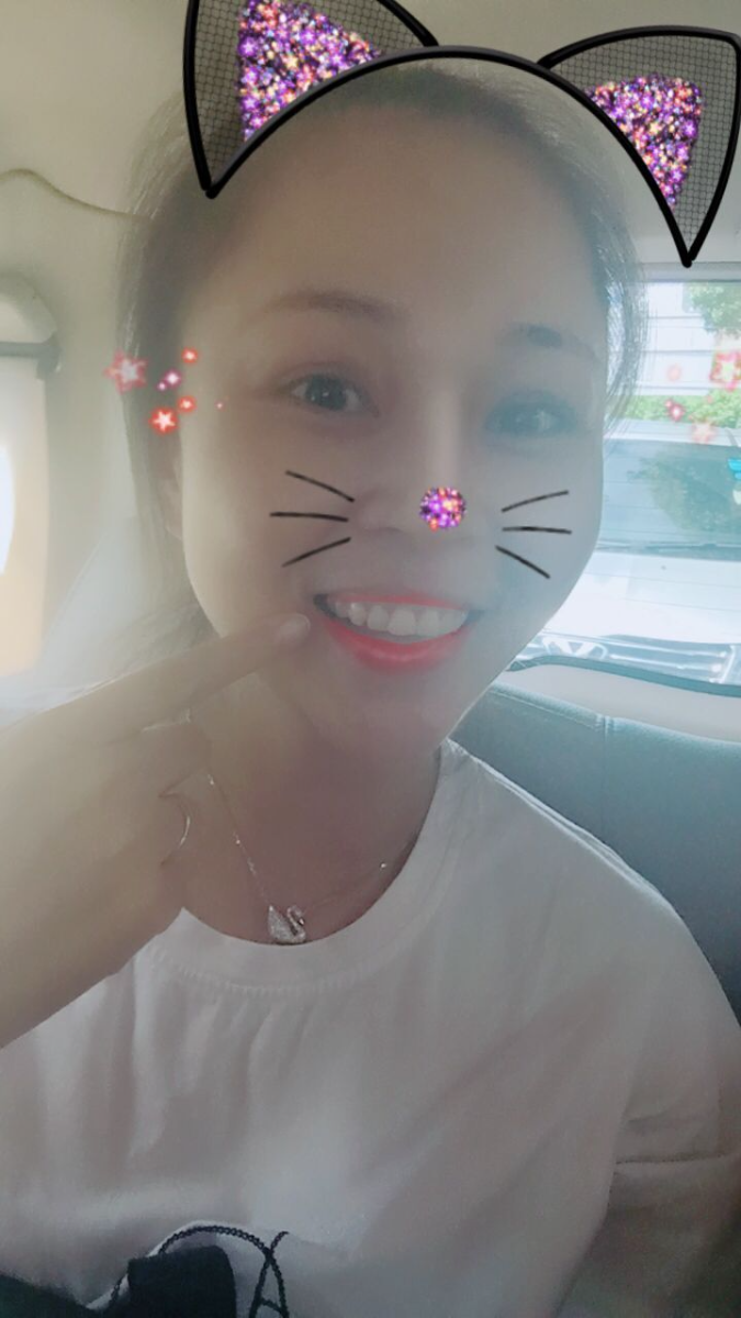 保定東陽口腔醫(yī)院趙星醫(yī)生做牙齒瓷貼面怎么樣？附牙齒瓷貼面案例效果對比圖