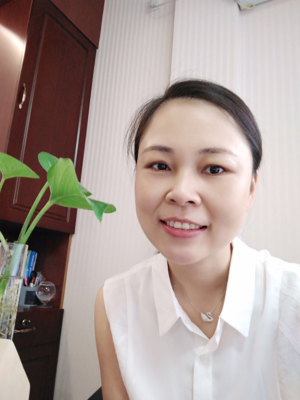 保定東陽口腔醫(yī)院趙星醫(yī)生做牙齒瓷貼面怎么樣?附牙齒瓷貼面案例效果對比圖