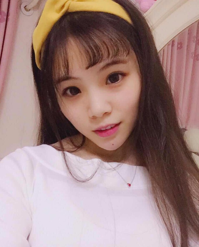 保定市第五醫(yī)院美容整形科做玻尿酸墊下巴怎么樣？附楊瑞萍醫(yī)生案例效果圖