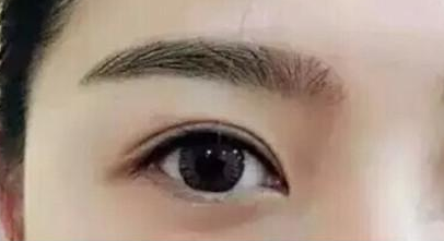 黑眼圈打膠原蛋白有用嗎？
