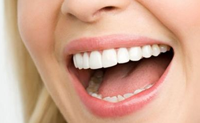 皓齒美白的價(jià)格一般是多少？手術(shù)價(jià)錢貴不貴？