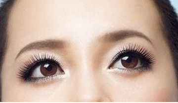 做完雙眼皮手術(shù)要忌口多長(zhǎng)時(shí)間？
