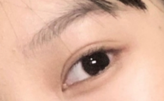 全切雙眼破的優(yōu)勢有哪些？
