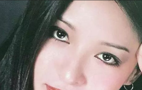 割雙眼皮會(huì)反彈嗎？