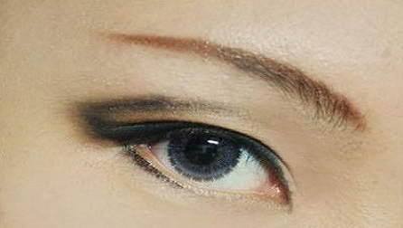 疤痕皮膚可以割雙眼皮嗎？40歲做埋線雙眼皮的效果好不好？