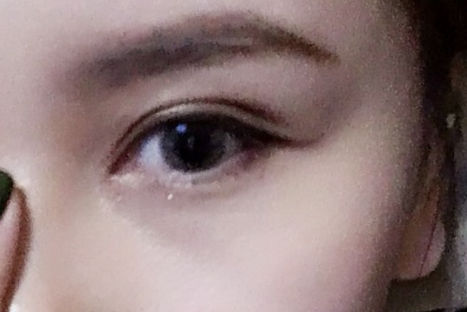 做雙眼皮對眼睛視力有影響嗎？雙眼皮對身體有沒有危害？
