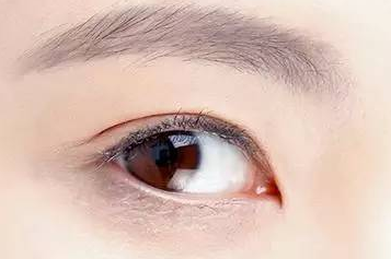 開內(nèi)眼角大概多少錢？開內(nèi)眼角大概需要多久恢復(fù)？