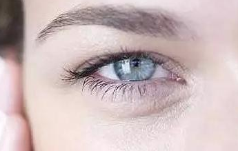 開內(nèi)眼角的弊端有哪些？