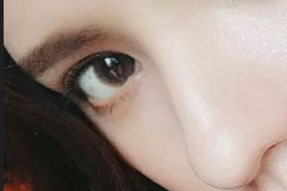 開眼角有害嗎？