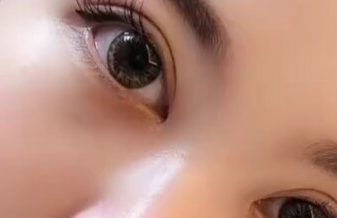 開眼角有沒有風險？