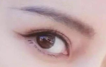 外眼角開大會留疤嗎？