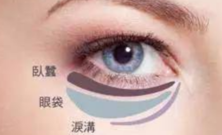 激光能祛除眼袋嗎？