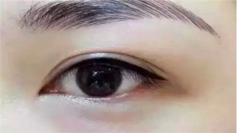昆山雙眼皮整形醫(yī)院哪幾家好？實(shí)力口碑醫(yī)院推薦！