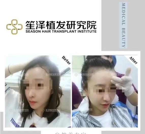 長(zhǎng)沙笙澤植發(fā)研究院