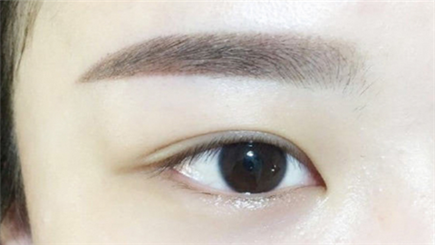 全國(guó)十大雙眼皮整形醫(yī)院有哪家？十家人氣醫(yī)院不容錯(cuò)過(guò)！