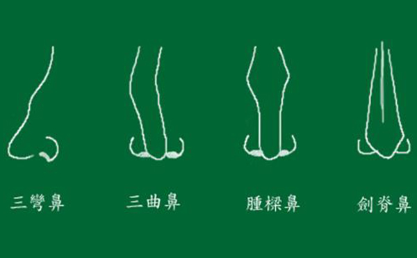 彎鼻矯正術(shù)后如何護理？要注意些什么？