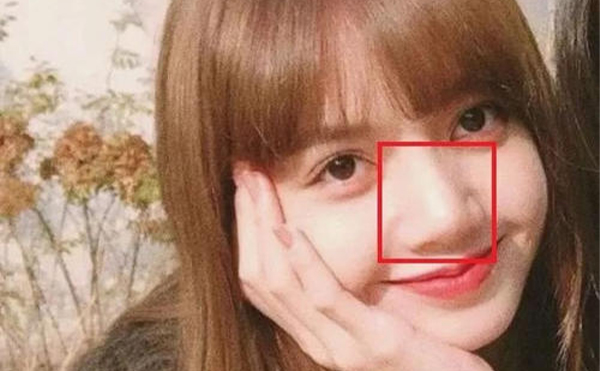 鼻子太大怎么辦？怎么改善大鼻頭