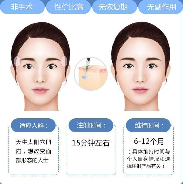豐太陽穴多少錢？
