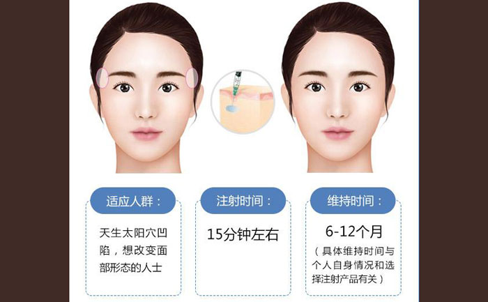 玻尿酸豐太陽(yáng)穴一般幾支？