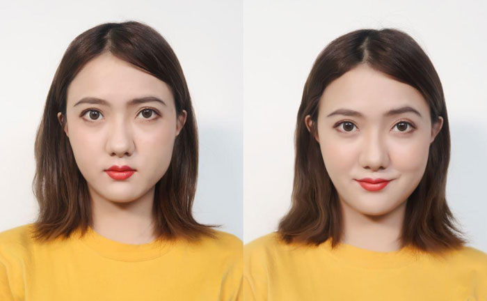 大小臉是什么原因造成的？大小臉怎么辦怎么矯正？