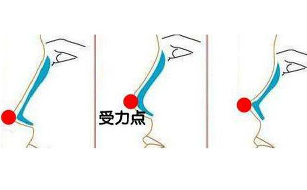 假體隆鼻假體取出難度大嗎?假體取出會(huì)怎么樣?
