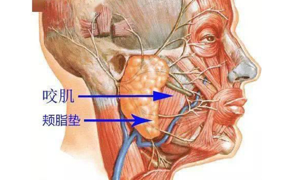 面部吸脂和取頰脂墊有什么區(qū)別?哪個效果好?