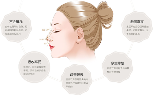 自體軟骨隆鼻可以永久的嗎？