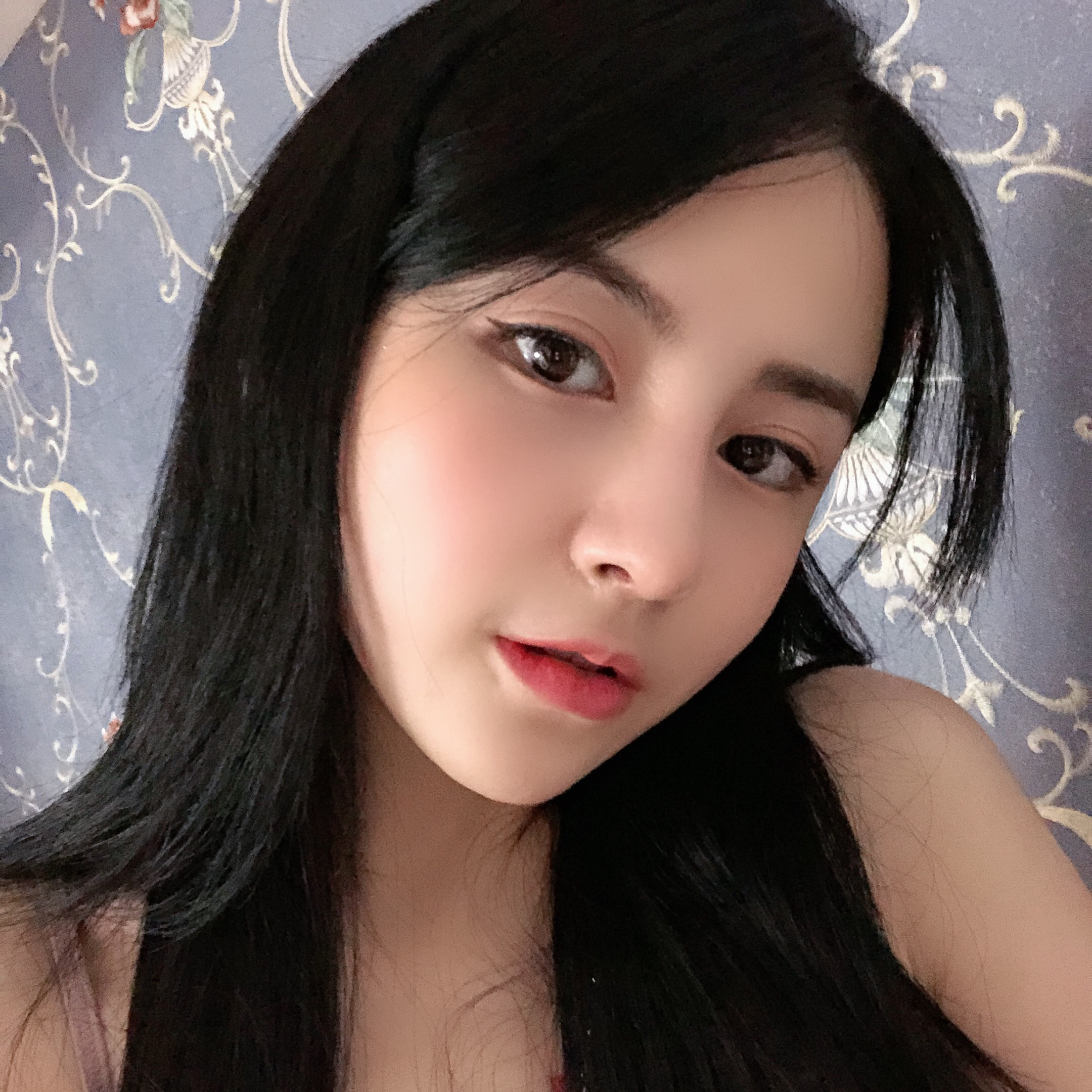 隆鼻手術術后效果2