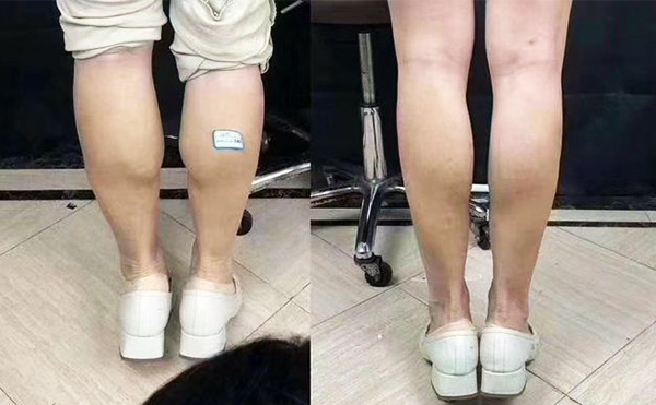 boxo瘦腿好嗎？