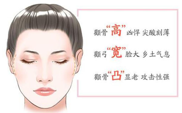 顴骨內(nèi)推整形適宜人群？