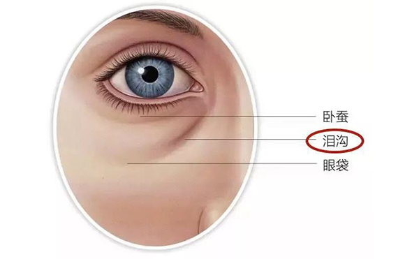 眼袋和臥蠶有什么區(qū)別?去眼袋會影響臥蠶嗎?
