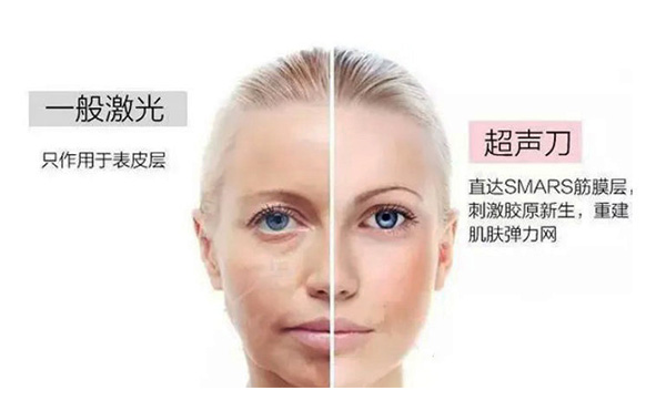 超聲刀有什么優(yōu)勢(shì)？