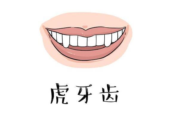 虎牙矯正需要多久？