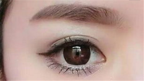 開內(nèi)眼角要多久能恢復(fù)？