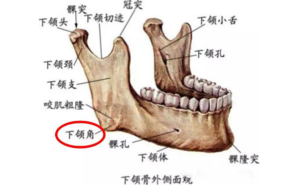 下頜角肥大應該怎么辦呢?