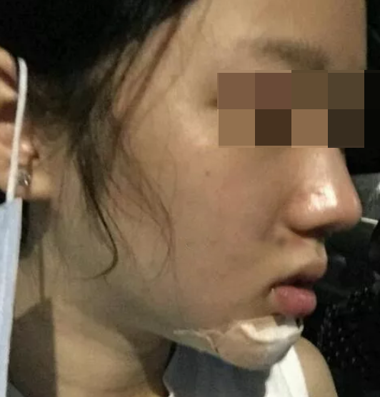 輪廓立體，更自信
